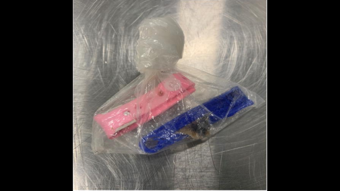“Biological materials” and a medical wristband were found in a passenger’s bag at the New Orleans, Louisiana, airport on Aug. 2, Customs and Border Protection officials said.