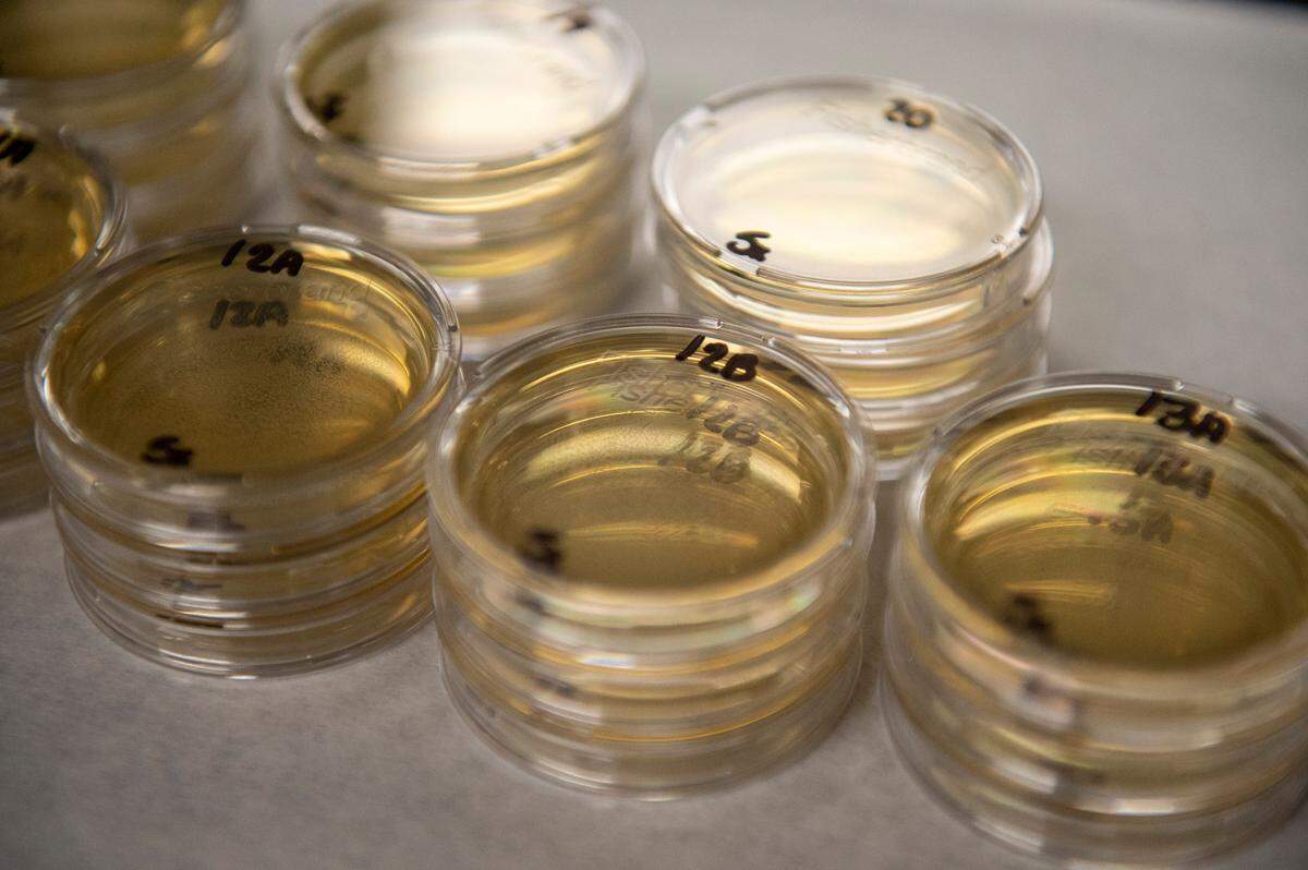 Display trays called medias filled with water samples collected from beaches on Wednesday, April 30, 2025. If the medias contain enterococcus, a bacteria that can cause infection, small groups of blue dots will appear on the media after being in an incubator for 24 hours.