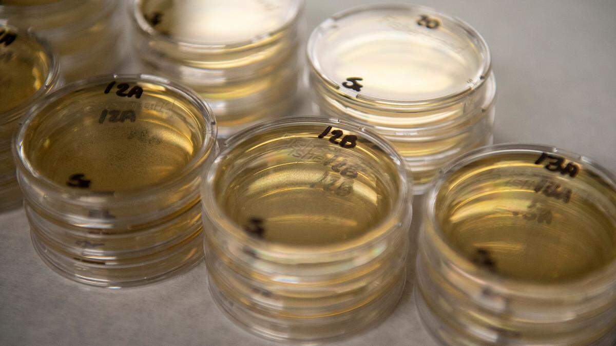 Display trays called medias filled with water samples collected from beaches on April 30, 2025. If the medias contain enterococcus, a bacteria that can cause infection, small groups of blue dots will appear on the media after being in an incubator for 24 hours.