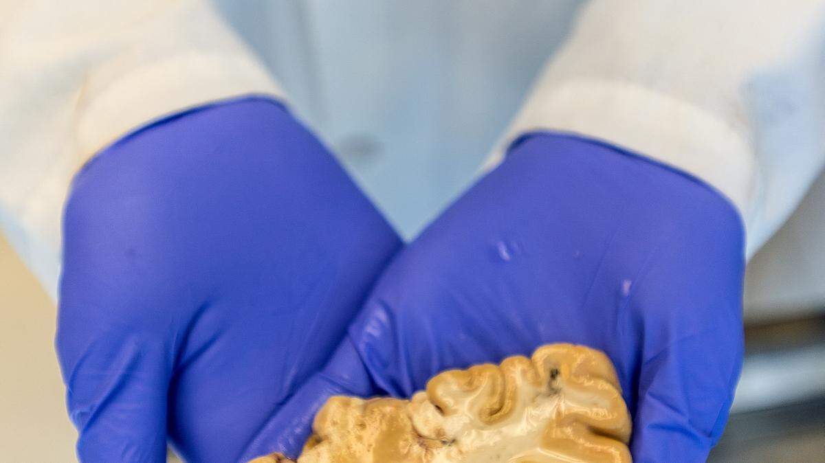 Washington PostSenior research associate Julie Nyhus at the Allen Institute for Brain Science in Seattle, Washington, holds a slice of human brain being used in research on September 16.