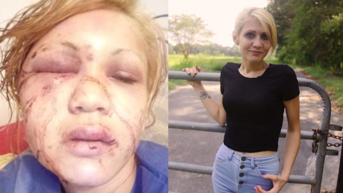 ‘There is a way out.’ After cycle of abuse nearly killed her, Coast woman shares her story.