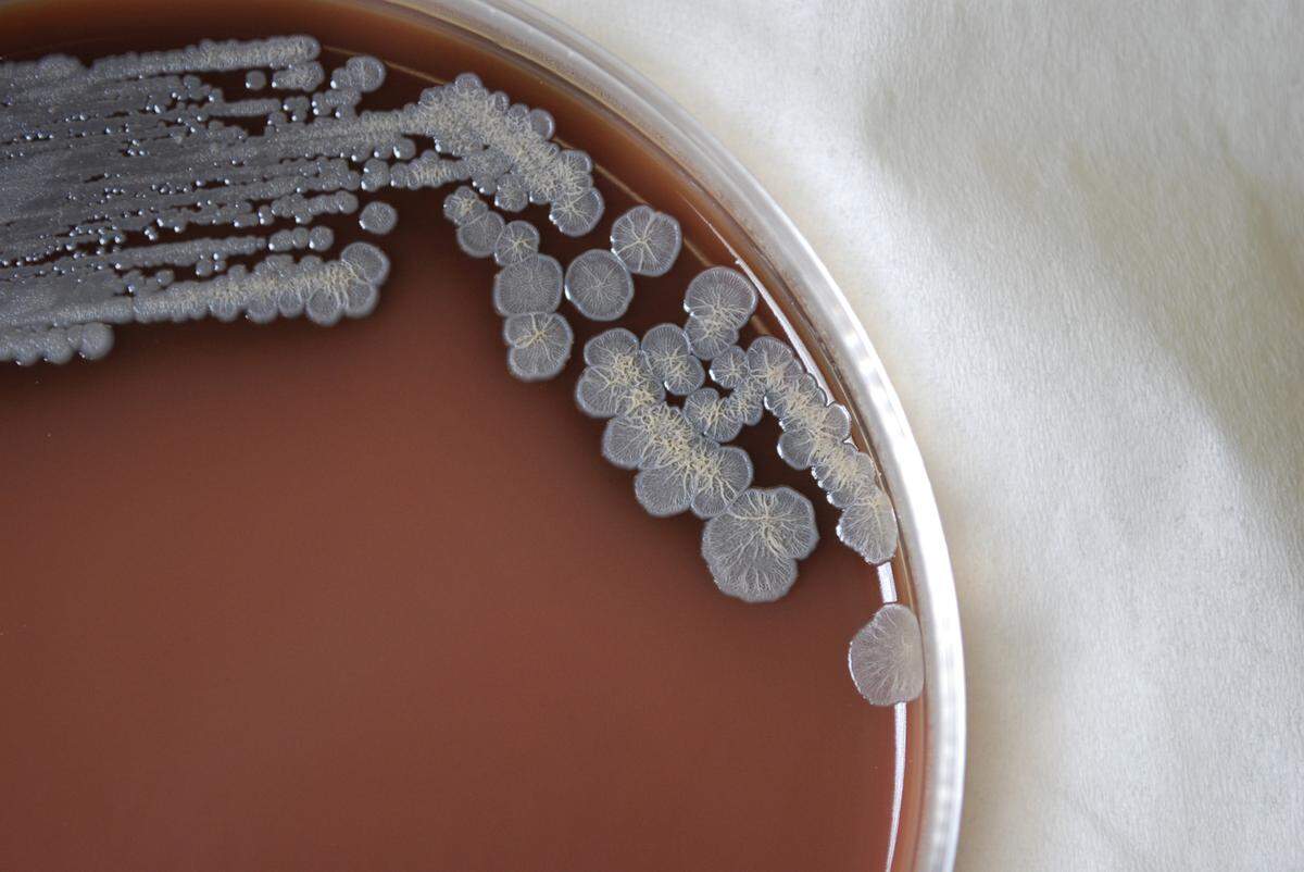 This photograph depicts the Burkholderia pseudomallei bacteria, which is the cause for the infectious disease melioidosis. The bacteria was discovered in soil in the Gulf Coast region in 2022. The Centers for Disease Control and Prevention recommend avoiding contact with soil or muddy water, especially if you have open wounds or suffer from diabetes, chronic kidney disease or chronic lung disease.