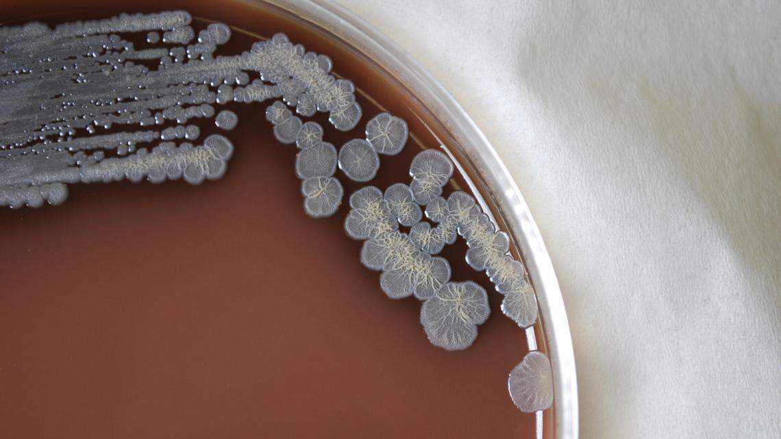 What to know about melioidosis, the rare disease just uncovered on the Mississippi Coast