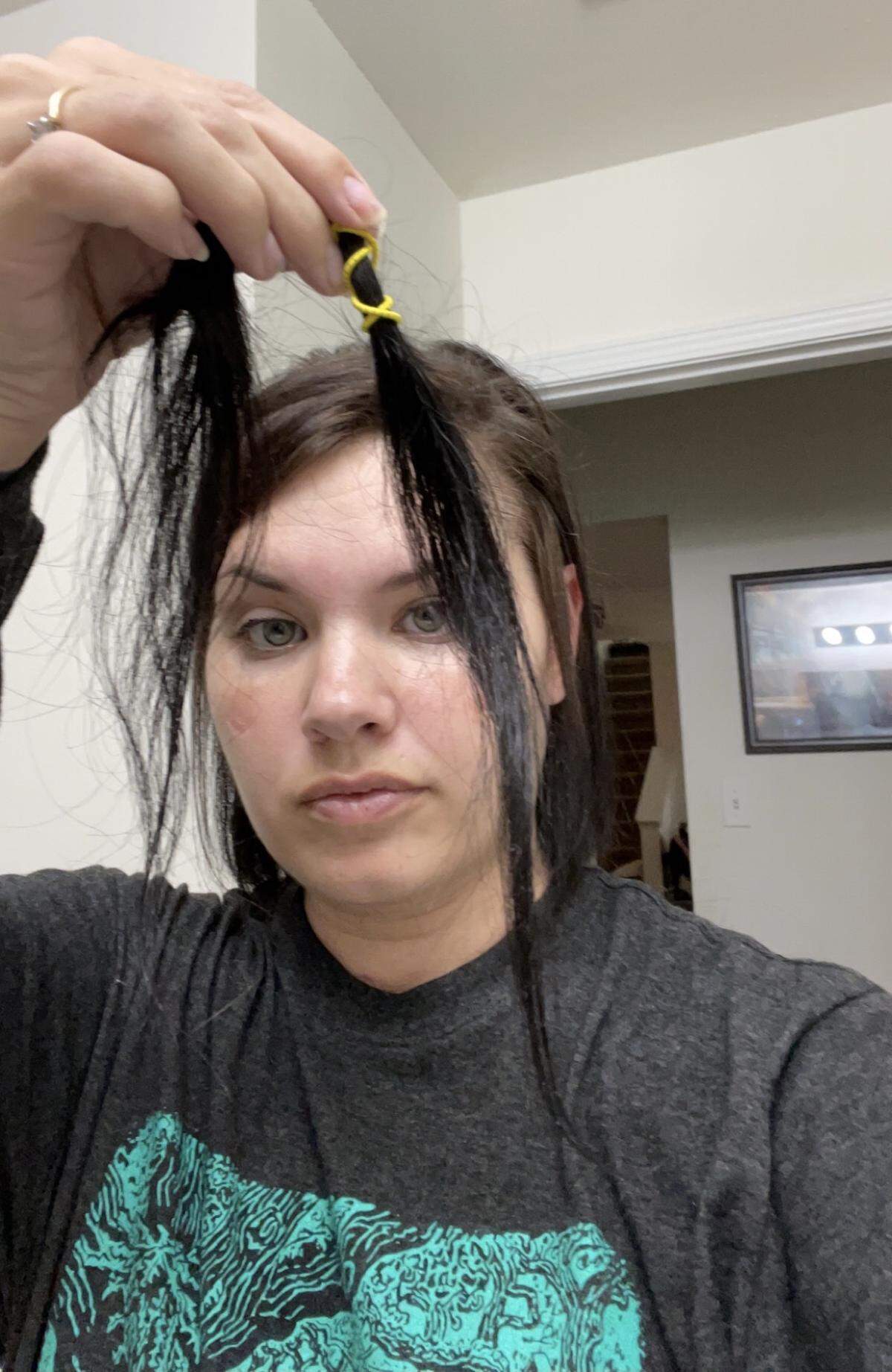 Ocean Springs resident Taylor Manning showing her hair loss, a COVID long haul symptom.