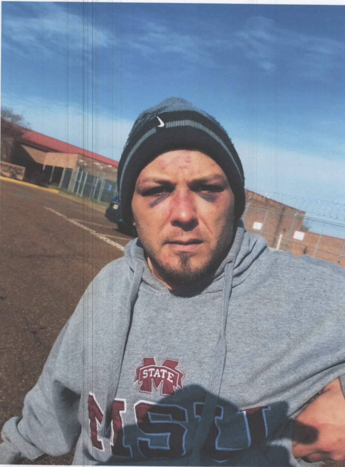 A photo of Christopher Mack in front of the Rankin County jail that he said was taken after he was beaten by officers.