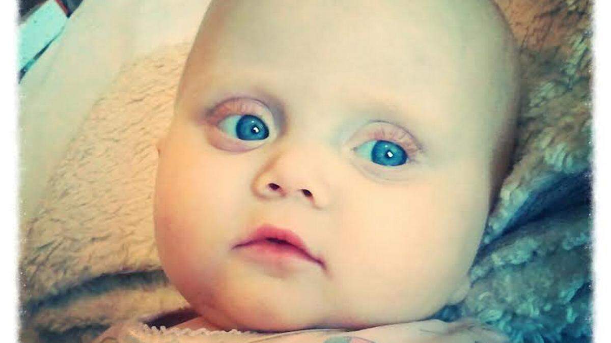 COURTESY SEAL FAMILYBella Seal has been on dialysis all her life because her kidneys have not worked since she was born. Her parents turned to the fundraising website GoFundMe to help with medical expenses their insurance does not cover.
