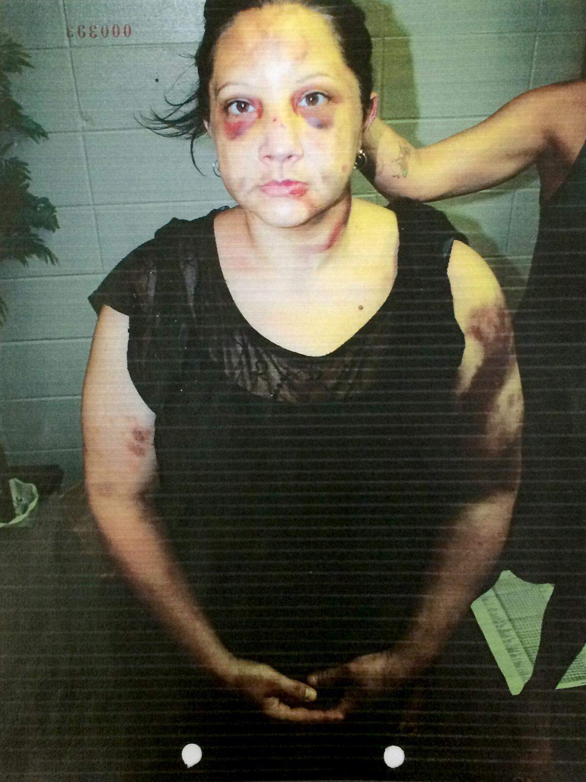A photograph from her case file shows the aftermath of Dawn Franklin’s last encounter with David Adele, which nearly killed her, on July 16, 2012.