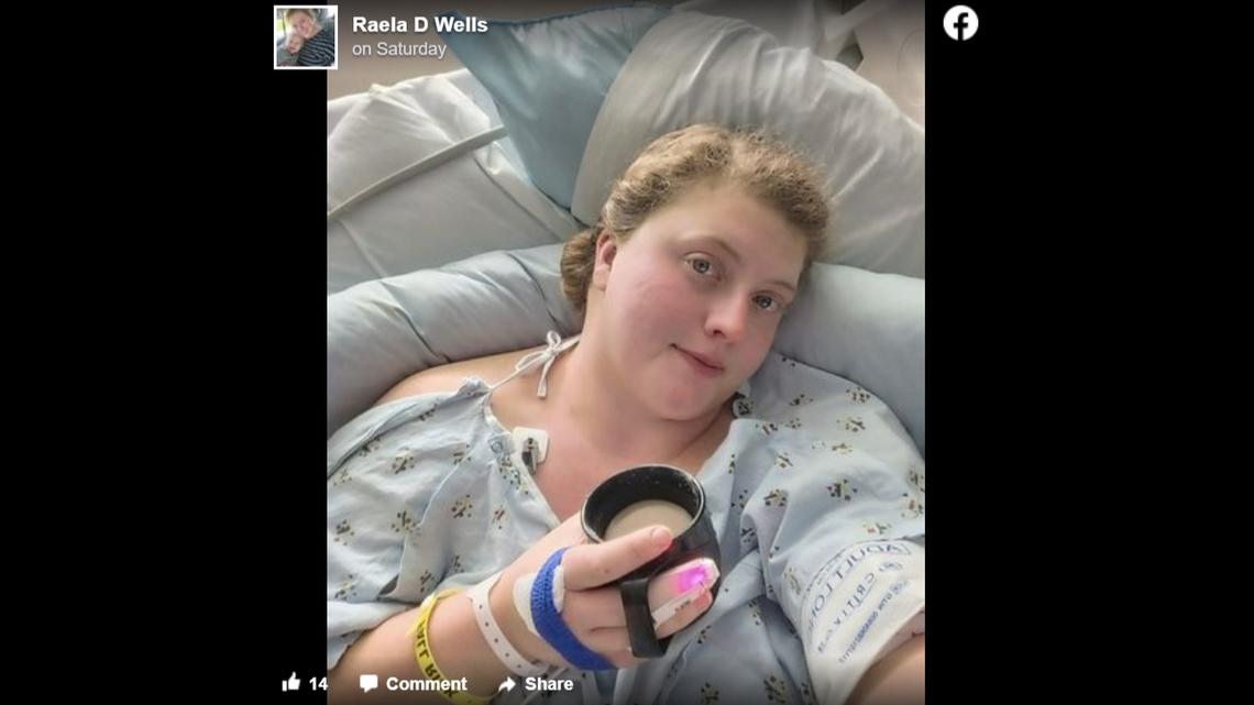 A copperhead bit Raela Wells twice while she was walking her dogs last week, she says.