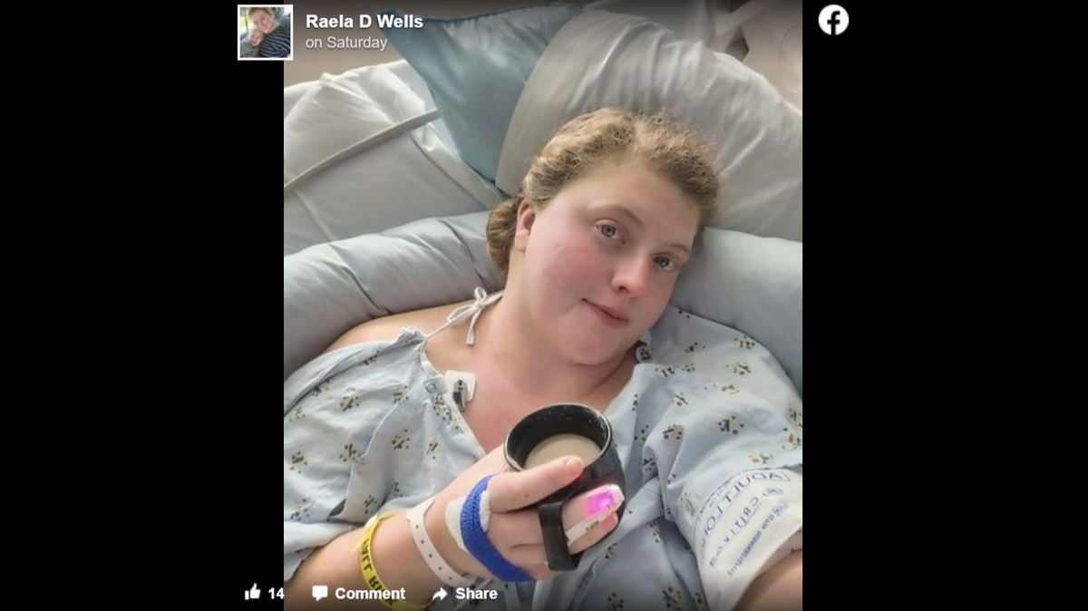 A copperhead bit Raela Wells twice while she was walking her dogs last week, she says.