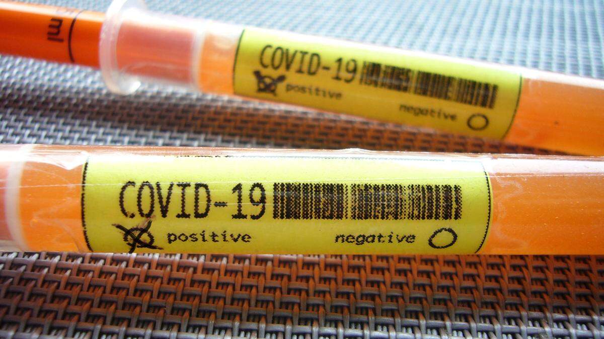 SYMBOL PHOTO: In almost all federal states, cases of infection have been confirmed with the new Coronavirus / Covid-19 (SARS-CoV-2). Test, ampoules, blood test, corona test. ? SVEN SIMON Fotoagentur GmbH & Co. Press Photo KG # Prinzess-Luise-Str. 41 # 45479 M uelheim / R uhr # Tel. 0208/9413250 # Fax. 0208/9413260 # GLS Bank # BLZ 430 609 67 # Kto. 4030 025 100 # IBAN DE75 4306 0967 4030 0251 00 # BIC GENODEM1GLS # www.svensimon.net. | usage worldwide Photo by: FrankHoermann/SVEN SIMON/picture-alliance/dpa/AP Images