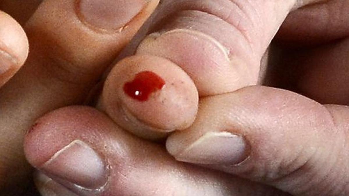 This photo shows a person giving a blood sample.