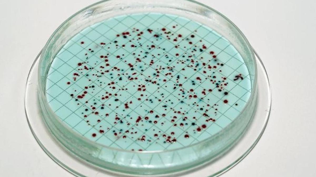 Bacteria come in many forms, but vibrio vulnificus, a rare and potentially deadly bacteria found in warm salt water has prompted health officials to warn those who venture into sea waters to be wary, especially if you have open cuts.