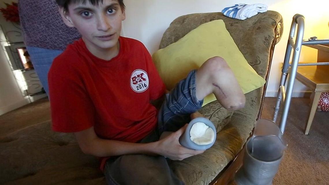 Why do pit bulls attack? The answer is complicated.