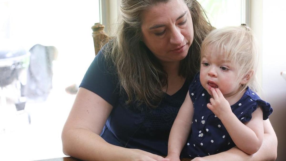 Amber Olsen holds her daughter, Willow Cannan, while at home in Ocean Springs on Friday, July 22, 2016. Willow has an extremely rare genetic disease called multiple sulfatase deficiency. Children with MDS have a life expectancy of 10 years or less.